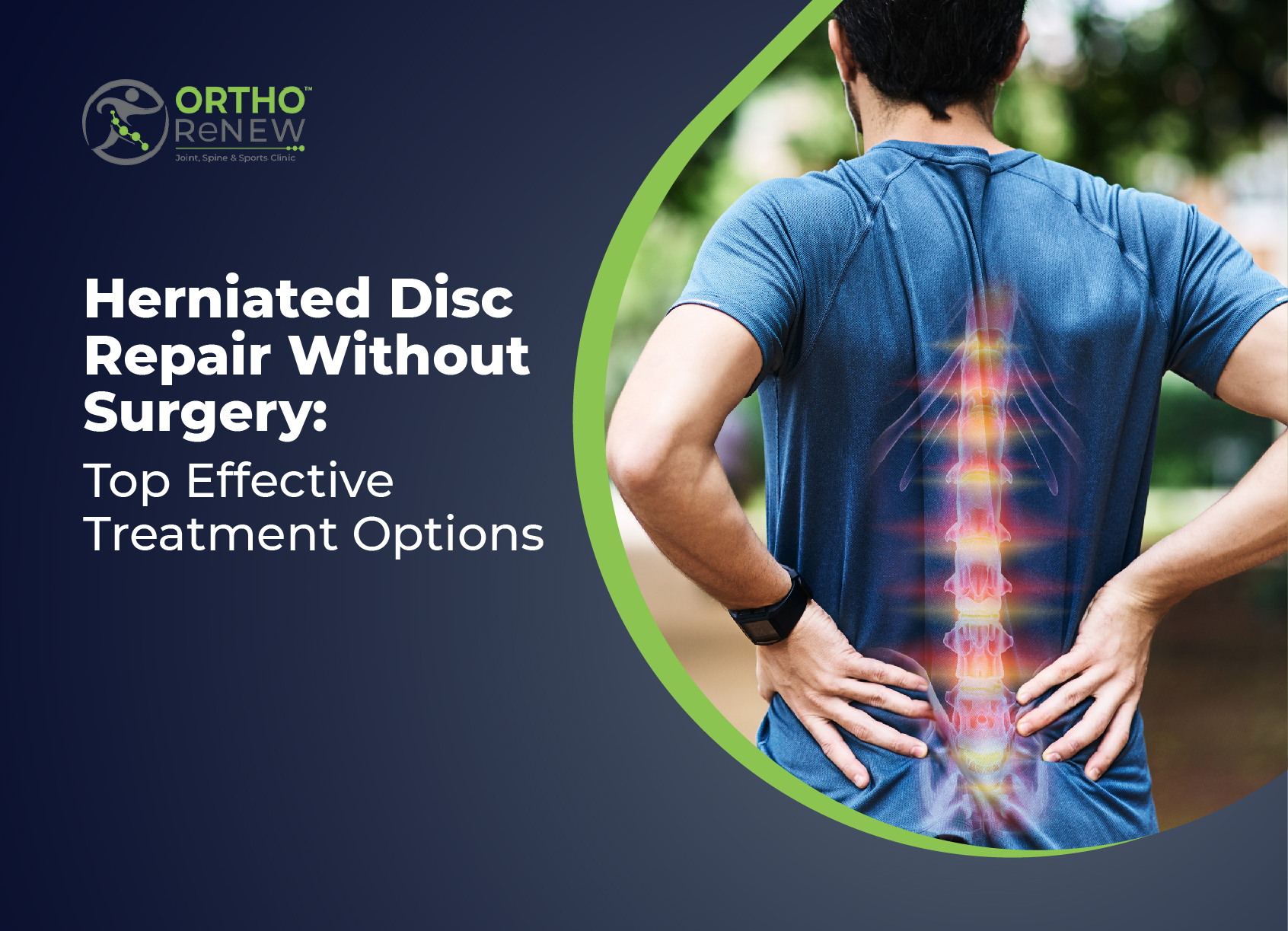 Herniated Disc Repair Without Surgery: Top Effective Treatment Options