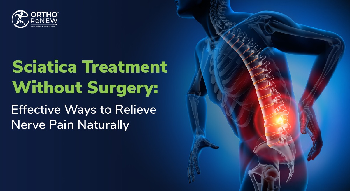 Sciatica Treatment Without Surgery