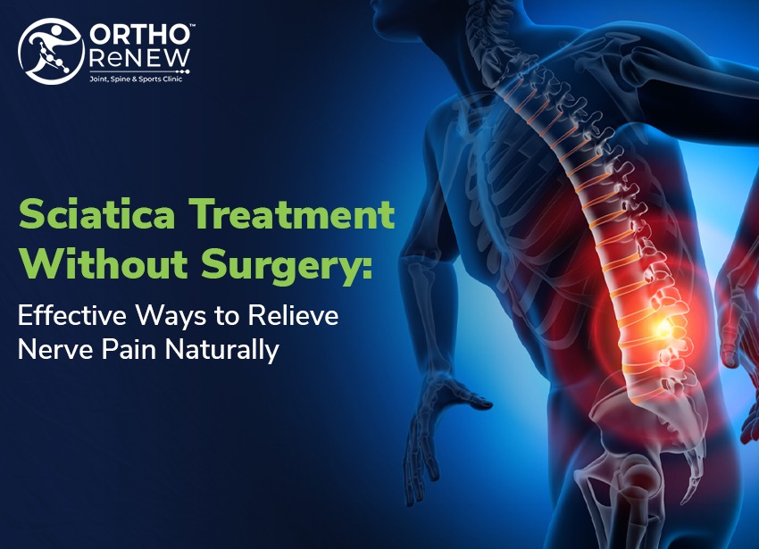 Sciatica treatment without surgery