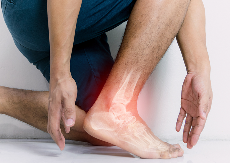Ankle Ligament Tear