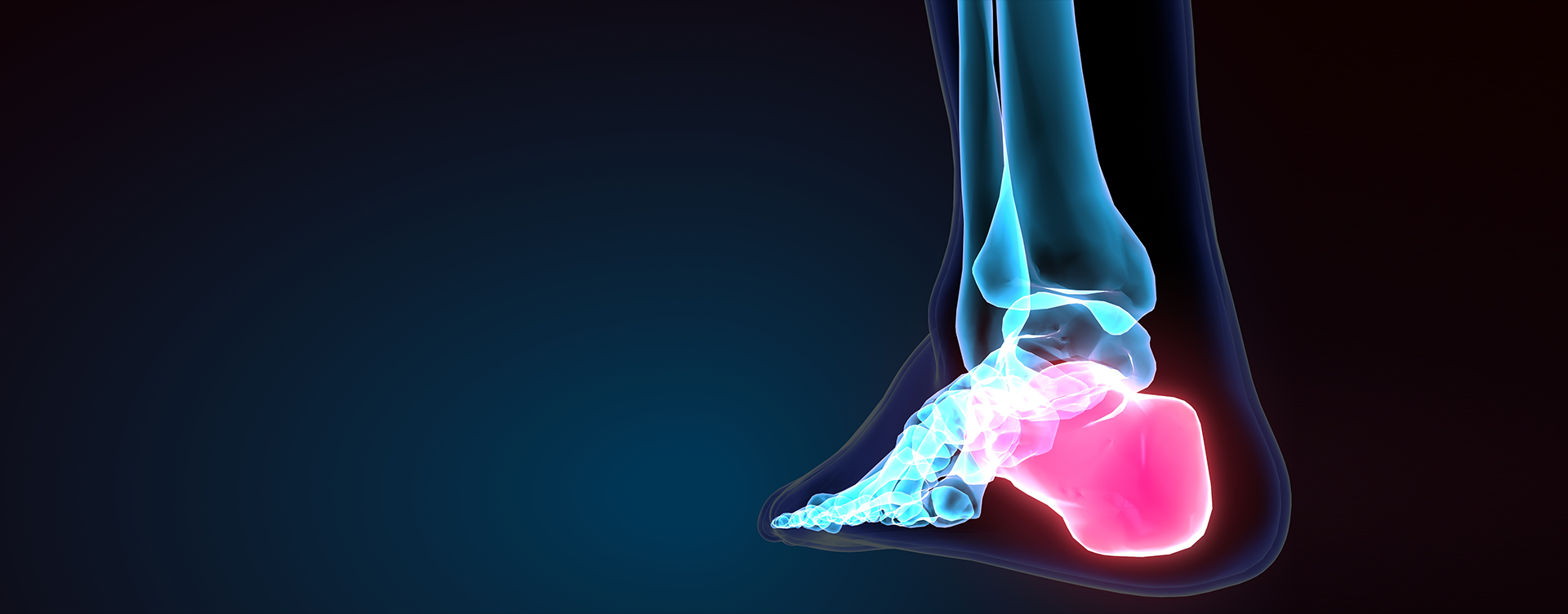Ankle Osteoarthritis