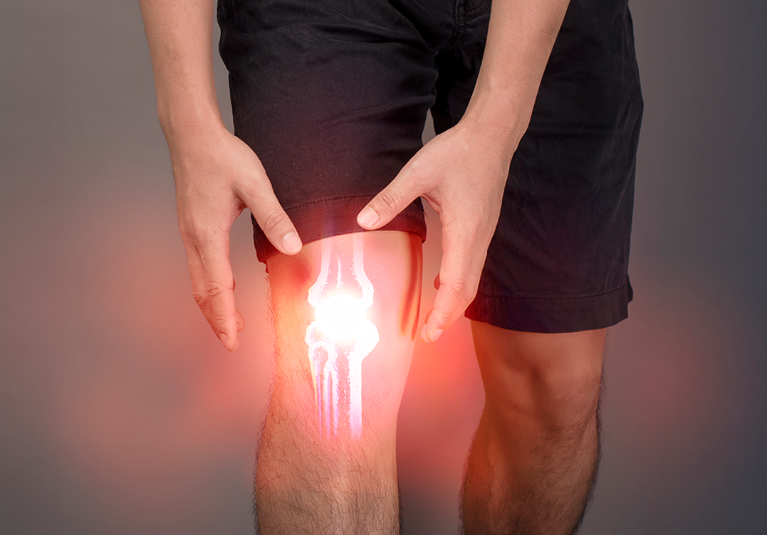 Knee Osteoarthritis