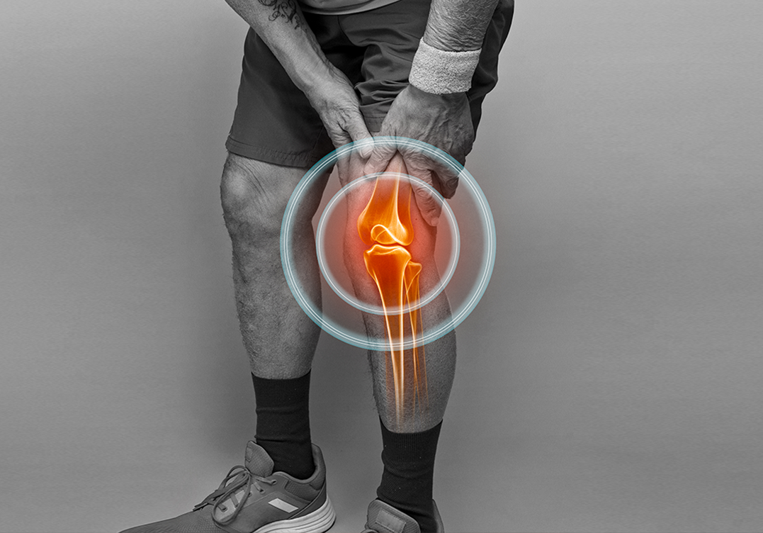 Meniscus Tears
